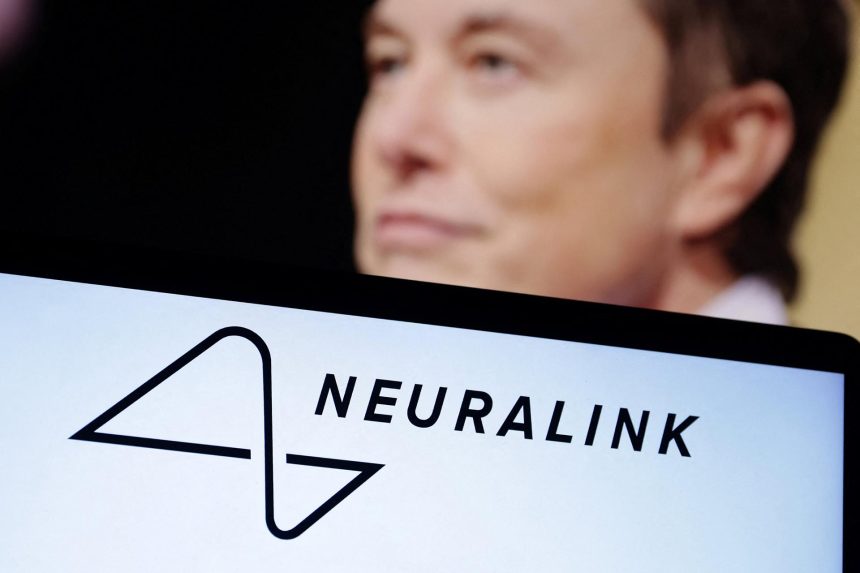 «Cela semble bien se passer» : Neuralink implante sa puce sur un deuxième patient